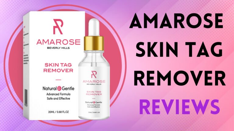 Amarose Skin Tag Remover Review